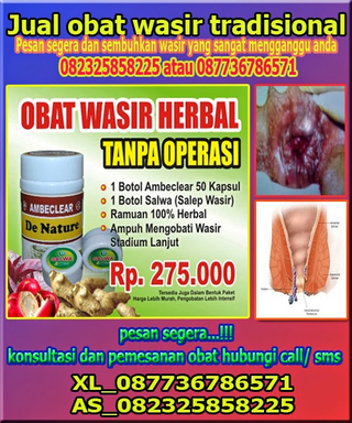 Illustration for article titled Pengobatan wasir
prof bafar